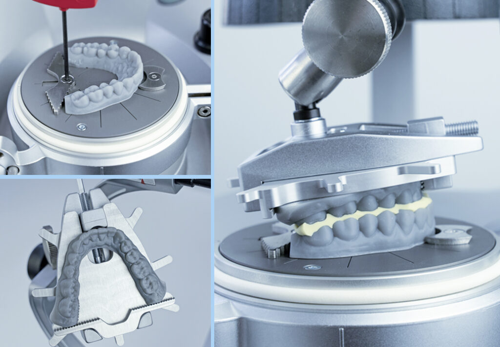 Erkodent 3D printing